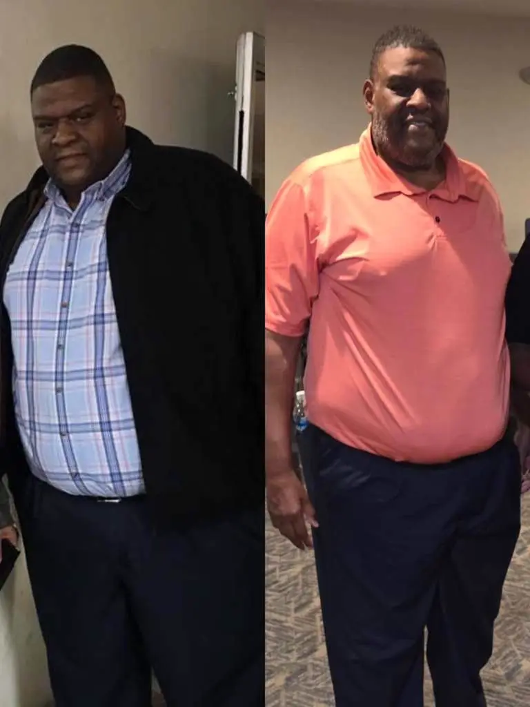 Customer before-and-after transformation photo 8: before on the left, after on the right