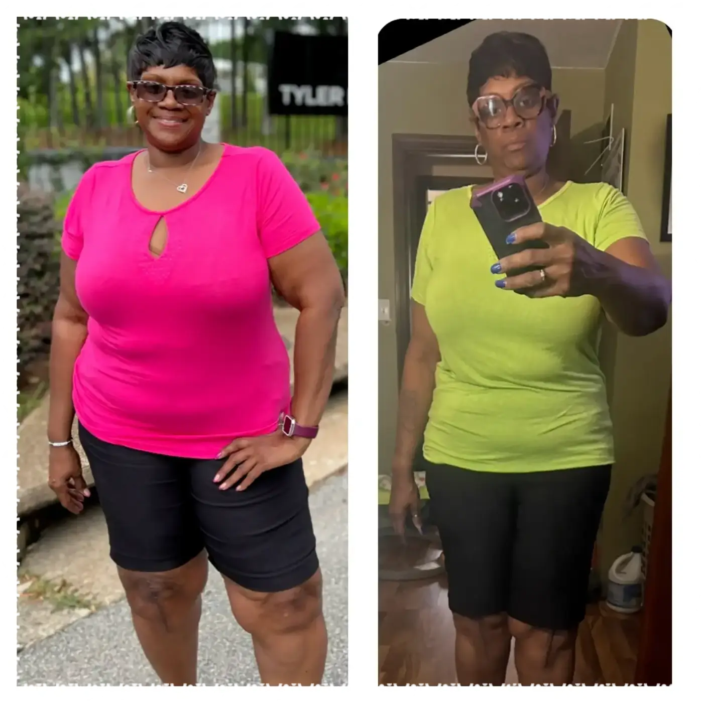 Customer before-and-after transformation photo 2: before on the left, after on the right