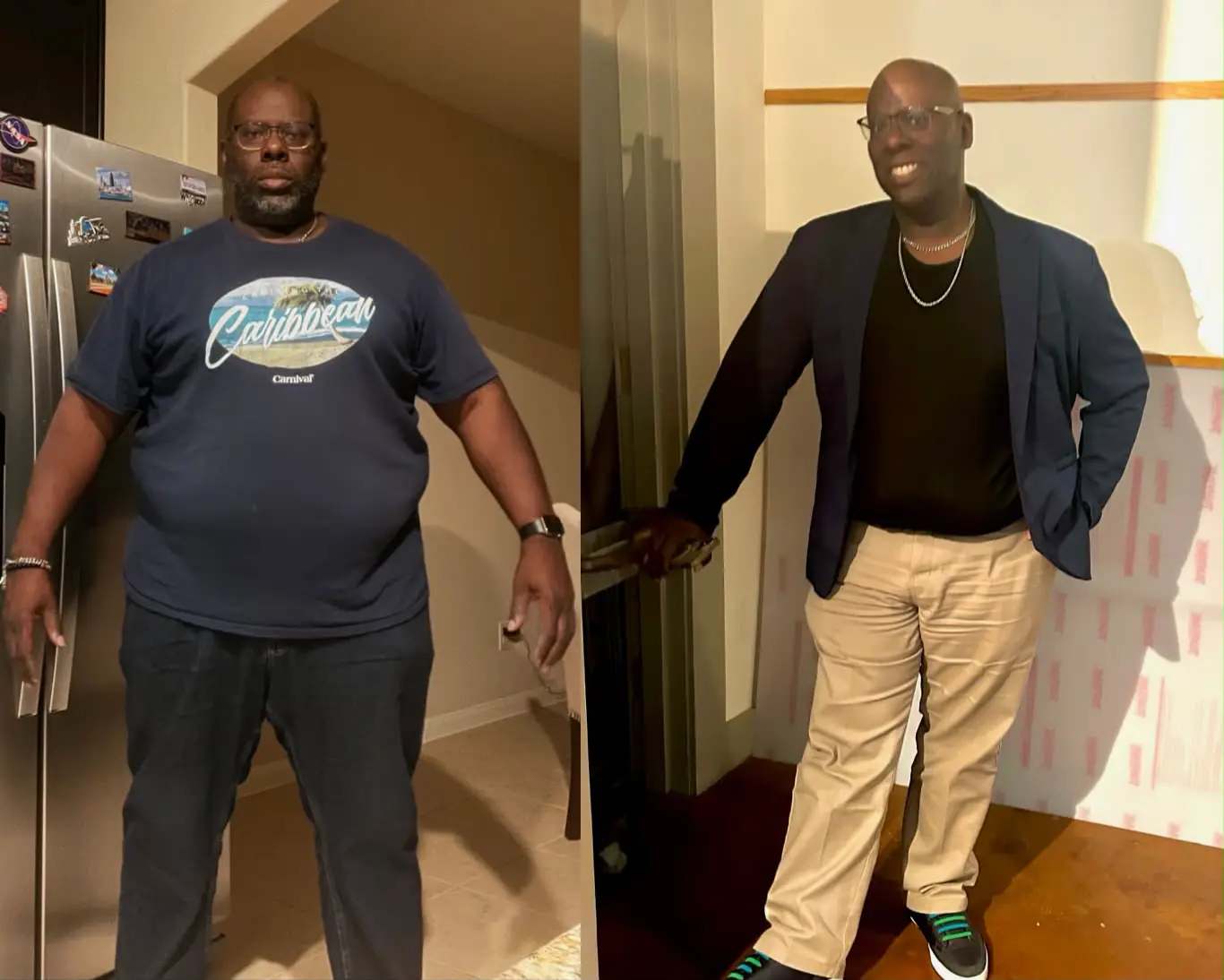 Customer before-and-after transformation photo 5: before on the left, after on the right